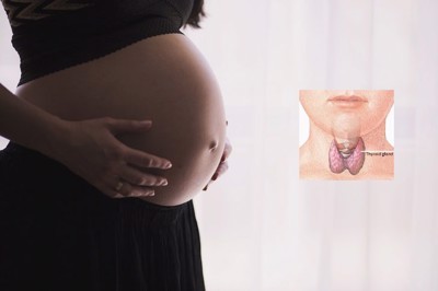 Nhiễm độc giáp thoáng qua ở thai kỳ